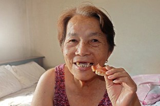 Lady has removed her denture