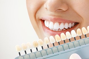 Fast teeth whitening versus inexpensive teeth whitening can affect your results