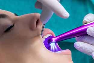 A dentist setting a woman’s dental sealants